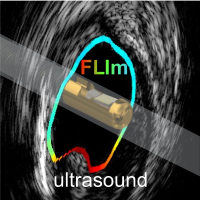 Ultrasound