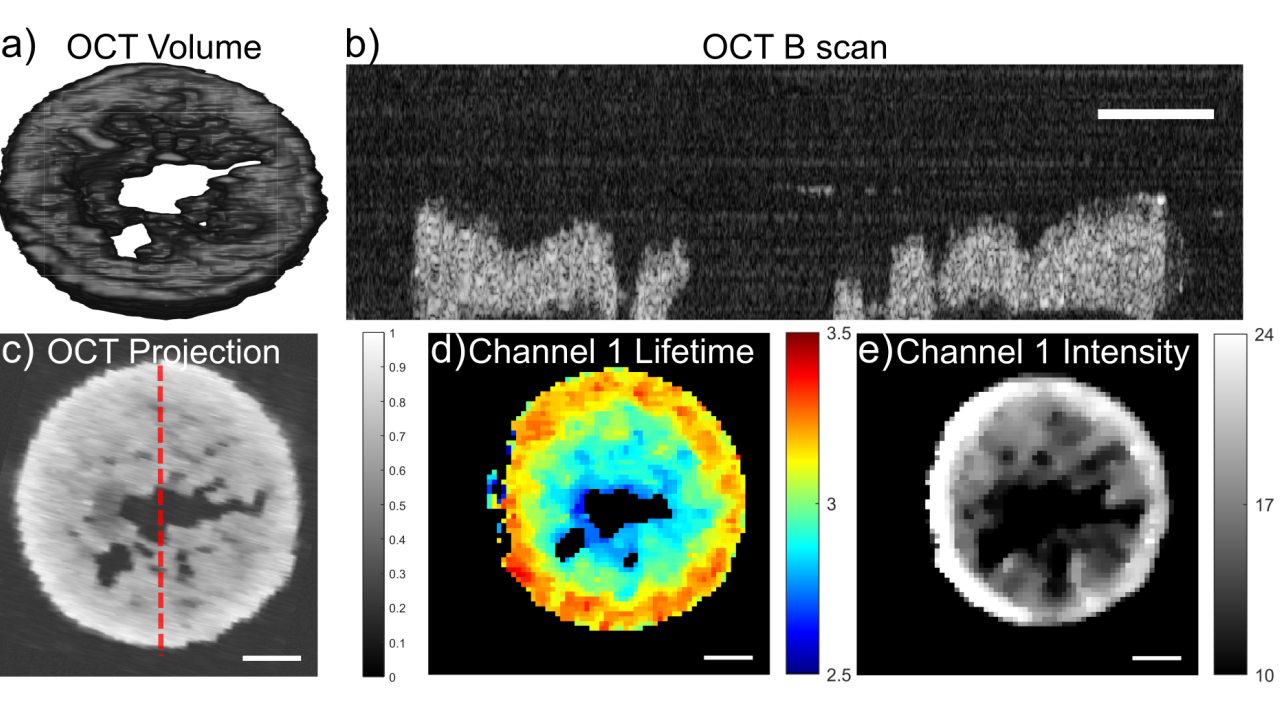 FLIm-OCT image of cartilage tissue construct