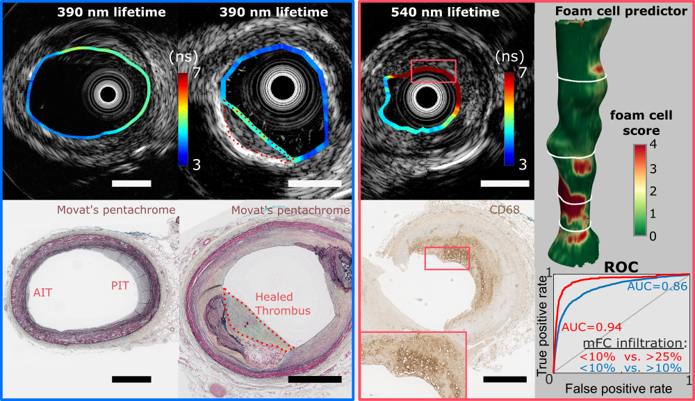 fluorescence lifetime images of artery