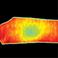 Tissue Engineering