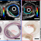 fluorescence lifetime images of artery